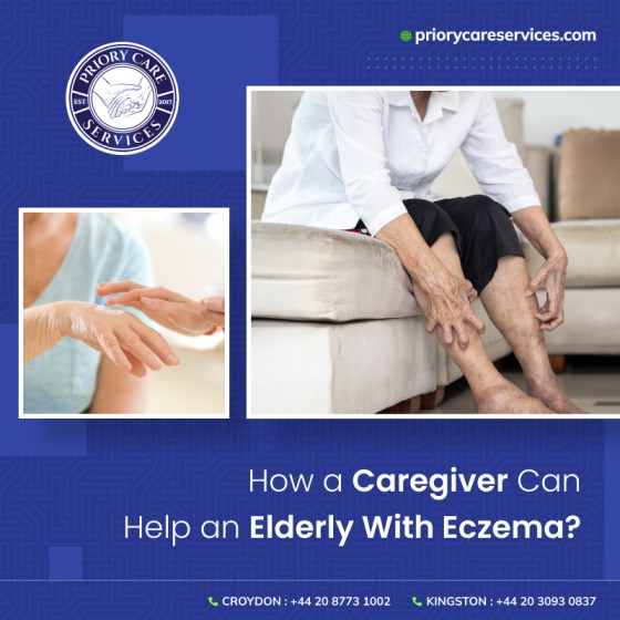 How a Caregiver Can Help an Elderly With Eczema